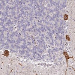 NCKAP5 Antibody, Novus Biologicals 25 &mu;L | Buy Online | Novus Biologicals | Fisher Scientific