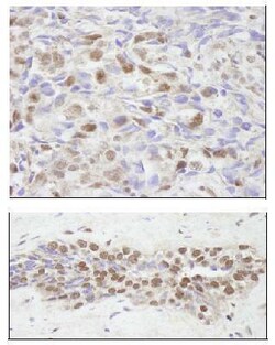 NCOA2 Antibody, Novus Biologicals 0.1mL; Unlabeled:Antibodies, Polyclonal