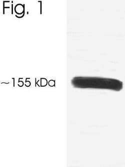 NCOA3/AIB1 Antibody, Novus Biologicals 0.1mg; Unlabeled:Antibodies, Polyclonal