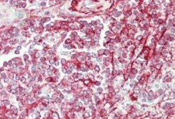 NCOA3/AIB1 Antibody, Novus Biologicals 0.1mg; Unlabeled:Antibodies, Polyclonal