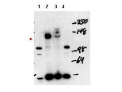 NCOA3/AIB1 Antibody, Novus Biologicals 0.1mg; Unlabeled:Antibodies, Polyclonal