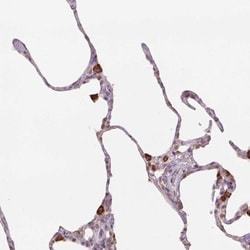 NCOA4 Antibody, Novus Biologicals 25 &mu;L, Unlabeled:Antibodies, Polyclonal