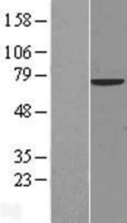 Novus Biologicals&trade;&nbsp;NCOA4 Overexpression Lysate