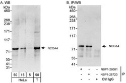 NCOA4 Antibody, Novus Biologicals 0.1mg; Unlabeled:Antibodies, Polyclonal