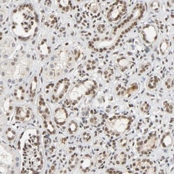 NCOA6 Antibody, Novus Biologicals:Antibodies:Primary Antibodies