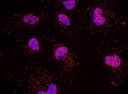 NCOR1 Antibody, Novus Biologicals 0.1 mL | Buy Online | Novus Biologicals | Fisher Scientific