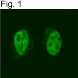 NCOR2 Antibody (1212) 0.1mg; Unlabeled:Antibodies, Monoclonal