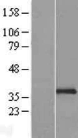Novus Biologicals&trade;&nbsp;NKp46/NCR1 Overexpression Lysate