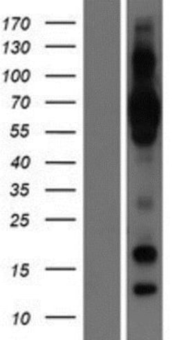 Novus Biologicals&trade;&nbsp;NCU-G1 Overexpression Lysate