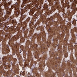 N-Deacetylase/N-Sulfotransferase 1/NDST1 Antibody, Novus Biologicals 25