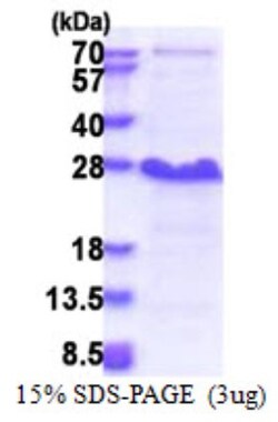 Novus Biologicals&trade;&nbsp;Recombinant Human NDFIP1 His Protein