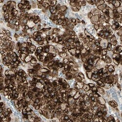 NDFIP1 Antibody, Novus Biologicals 0.1mL; Unlabeled:Antibodies, Polyclonal