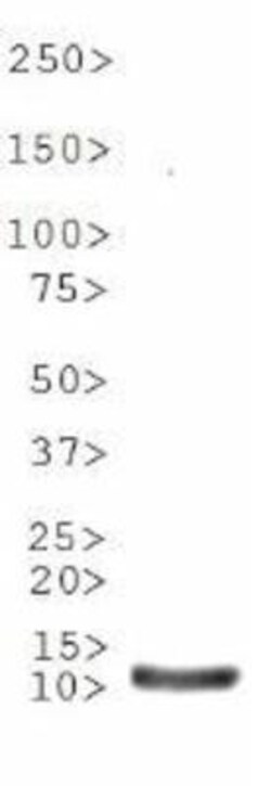 NDM-1 Antibody - BSA Free, Novus Biologicals 0.025 mL | Buy Online | Novus Biologicals | Fisher Scientific