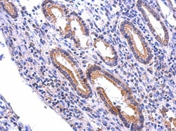 NDOR1 Antibody, Novus Biologicals 0.1mL; Unlabeled:Antibodies, Polyclonal