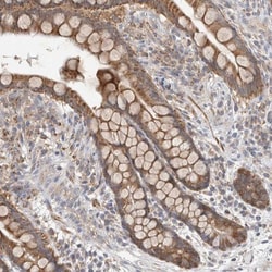 NDOR1 Antibody, Novus Biologicals 0.1 mL | Buy Online | Novus Biologicals | Fisher Scientific