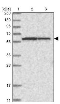 NDOR1 Antibody, Novus Biologicals 0.1 mL | Buy Online | Novus Biologicals | Fisher Scientific
