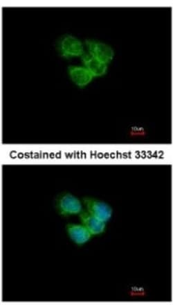 NDP52 Antibody, Novus Biologicals 0.1mL; Unlabeled:Antibodies, Polyclonal