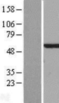 Novus Biologicals&trade;&nbsp;NDP52 Overexpression Lysate