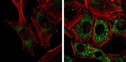 NDP52 Antibody (1813), Novus Biologicals 0.1mL; Unlabeled:Antibodies, Monoclonal
