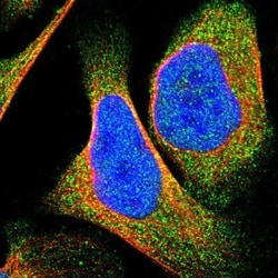 NDP52 Antibody, Novus Biologicals 25 &mu;L; Unlabeled:Antibodies, Polyclonal