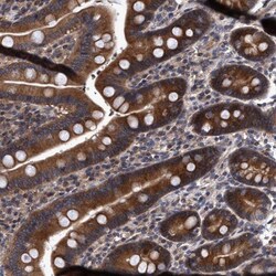 NDP52 Antibody, Novus Biologicals 25 &mu;L; Unlabeled:Antibodies, Polyclonal