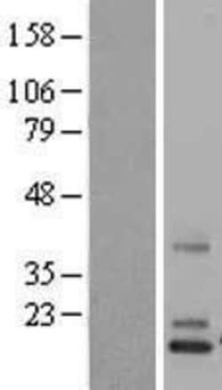 Novus Biologicals&trade;&nbsp;Norrin/NDP Overexpression Lysate