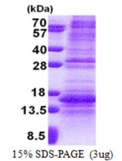 Novus Biologicals Recombinant Human Norrin/NDP His Protein 0.05 mg | Buy Online | Novus Biologicals&trade; | Fisher Scientific