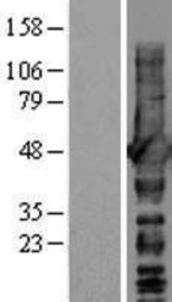 Novus Biologicals&trade;&nbsp;NDRG1 Overexpression Lysate