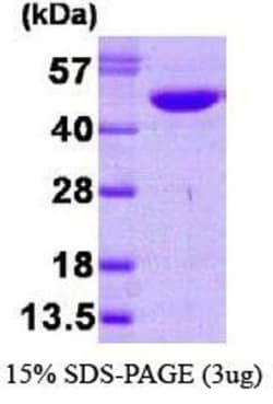 Novus Biologicals&trade;&nbsp;Recombinant Human NDRG1 His Protein
