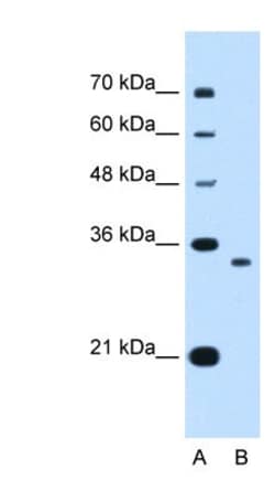 NDRG2 Antibody, Novus Biologicals 0.05mg; Unlabeled:Antibodies, Polyclonal