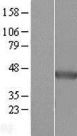Novus Biologicals&trade;&nbsp;NDRG2 Overexpression Lysate