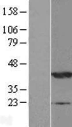 Novus Biologicals&trade;&nbsp;NDRG2 Overexpression Lysate