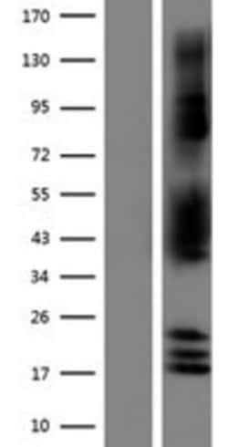 Novus Biologicals&trade;&nbsp;NDRG2 Overexpression Lysate