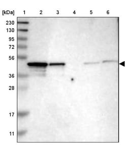 NDRG3 Antibody, Novus Biologicals 0.1mL; Unlabeled:Antibodies, Polyclonal