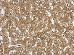 NDST3 Antibody, Novus Biologicals 0.1mL; Unlabeled:Antibodies, Polyclonal