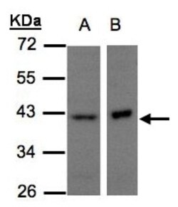 NDUFA10 Antibody, Novus Biologicals 0.1mL; Unlabeled:Antibodies, Polyclonal