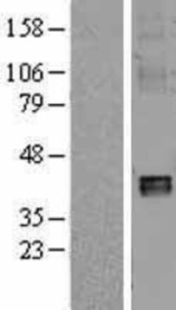 Novus Biologicals&trade;&nbsp;NDUFA10 Overexpression Lysate
