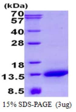 Novus Biologicals&trade;&nbsp;Recombinant Human NDUFA2 His Protein