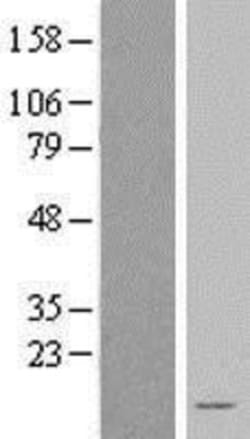 Novus Biologicals&trade;&nbsp;NDUFA3 Overexpression Lysate