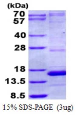 Novus Biologicals&trade;&nbsp;Recombinant Human NDUFA5 His Protein