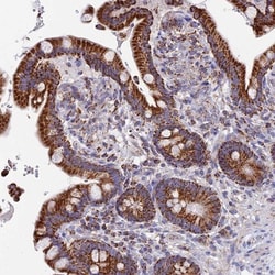 NDUFA5 Antibody, Novus Biologicals:Antibodies:Primary Antibodies