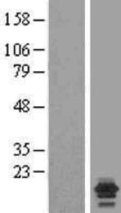 Novus Biologicals&trade;&nbsp;NDUFA7 Overexpression Lysate