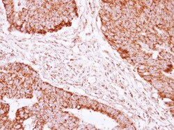 anti-NDUFAB1, Polyclonal, Novus Biologicals 0.1mL; Unlabeled:Antibodies,