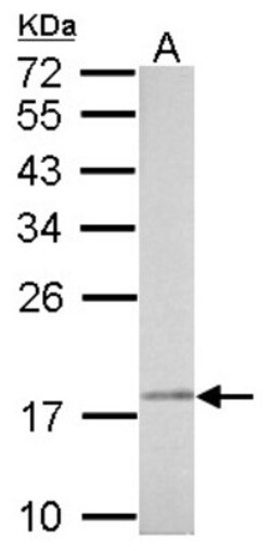 anti-NDUFAB1, Polyclonal, Novus Biologicals 0.1mL; Unlabeled:Antibodies,