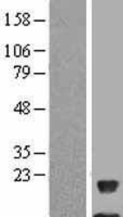 Novus Biologicals&trade;&nbsp;NDUFAB1 Overexpression Lysate