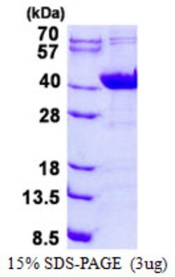 Novus Biologicals&trade;&nbsp;Recombinant Human NDUFAF1 His Protein