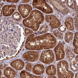 NDUFAF1 Antibody, Novus Biologicals:Antibodies:Primary Antibodies