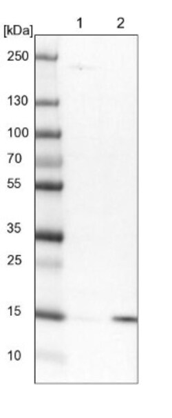 NDUFAF3 Antibody, Novus Biologicals 25 &mu;L; Unlabeled:Antibodies, Polyclonal