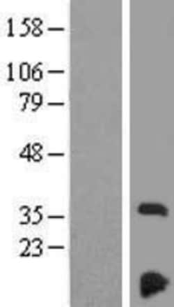 Novus Biologicals™ NDUFAF3 Overexpression Lysate