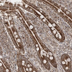 NDUFAF3 Antibody, Novus Biologicals 25 &mu;L; Unlabeled:Antibodies, Polyclonal